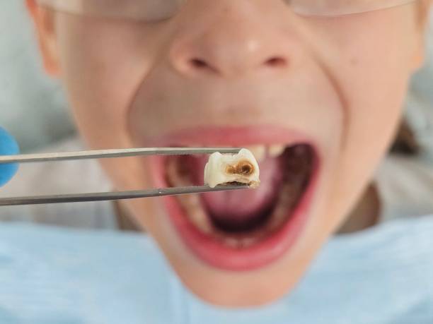 Best Pediatric Emergency Dentist in Swartzville, PA