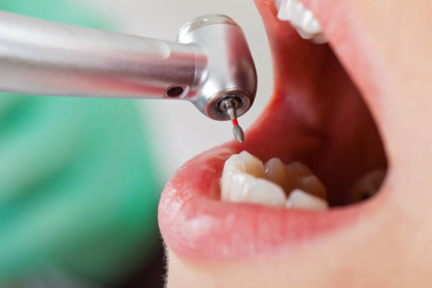 Best Emergency Dental Services for Seniors in Swartzville, PA
